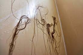 A golden retriever losing hair in clumps occurs because your dog is not getting the full spectrum of nutrients. The Hair Loss Guide For Women Plus Regrowth Tips Treatments Allure