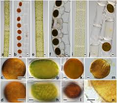 Et al., 2007) menyatakan kadar klorofil alfa dalam spirogyra adalah 2,1 mg/g. Nomarski Interference Micrographs Of Three Species Of Spirogyra Download Scientific Diagram