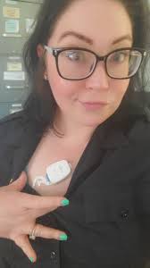 What are the normal side effects of a heart monitor?