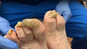 1) cual es tu tipo de uña? Unas Largas