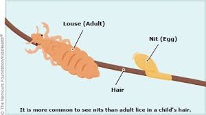 Image result for lice life cycle