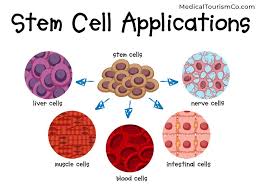 We did not find results for: Stem Cell Therapy For Diabetes In India Quality Safe Experienced Doctor