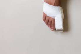 Image result for Toe Fracture