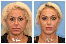 Danny Soares's Instagram, Twitter & Facebook