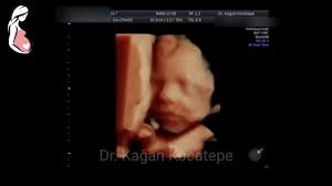 cesitli gebelik haftalarinda yapilmis bebek ultrason goruntuleri acikl bebek ultrason bebek