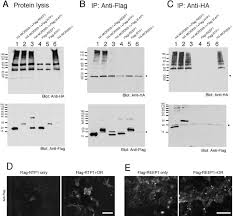 Excerto do programa o natal do tonecas emitido em 22 de dezembro de 2004 na rtp1. Rtp Family Members Induce Functional Expression Of Mammalian Odorant Receptors Sciencedirect