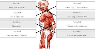 Er diagram tool to visualize how system entities like people or objects related to one another. The Glute Vs Tfl Muscle Battle Proper Exercise Selection To Correct Muscle Imbalance Athletic Medicine Has Moved