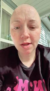 #stitch with @Cancer Patient, MD my heart goes out to Kim and her family.  Please keep them in your prayers and good vibes. #sarcomaawareness  #drkimcancerpatient #terminalcancer #stitch #rip ...