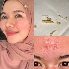 Sebenarnya cara memutihkan muka ini cukup mudah lho. Tanpa Pakai Krim Cara Memutihkan Wajah Ala Nabilah Rachmadhanty Ini Bikin Netizen Kaget