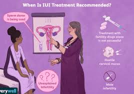 What Is Intrauterine Insemination Iui