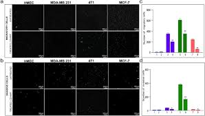 If the tumor is less than 2 centimeters in diameter, the prognosis is better; Nhf Derived Carbon Dots Prevalidation Approach In Breast Cancer Treatment Scientific Reports