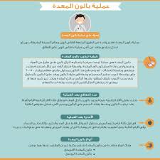 بالون المعدة بالمنظار د أحمد النبيل