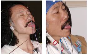 Healing from the Inside Out: How Your Mind–Body Shapes Pain