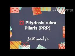 Naavagreen klinik perawatan wajah dan kulit mengutamakan pelayanan yang cepat, tepat dan profesional untuk mengatasi masalah komedo, jerawat, kusam, flek, kulit sensitif, keriput, penuaan. Video Pilaris