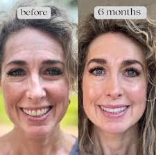 Skincare Product Recommendations and Reviews