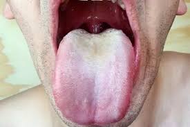 What Causes A Person To Develop A Chalky Taste In Their Mouth Quora