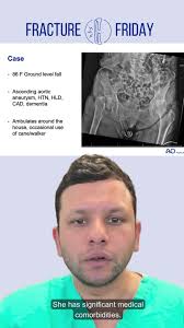 Meet 𝗗𝗿. 𝗗𝗮𝘃𝗶𝗱 𝗛𝘂𝗯𝗯𝗮𝗿𝗱, an orthopedic trauma surgeon and  educator at West Virginia University Hospital and an AO member. Dr. Hubbard  is dedicated to advancing orthopedic care and education as an AO