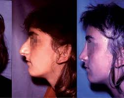 Cirugia plastica revista 20120109.indd