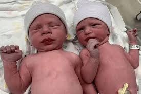Bu bebekler yeni doğdular ama 31 yaşındalar