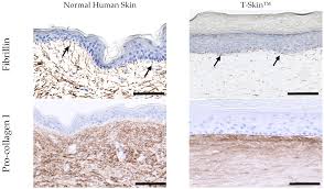 This overview of normal moles pictures includes pictures of moles and other skin spots that you can use as a first comparison to any moles on your body. Ijms Free Full Text Characterization Of A New Reconstructed Full Thickness Skin Model T Skin And Its Application For Investigations Of Anti Aging Compounds Html