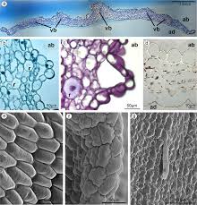 We did not find results for: A Cross Section Of Lateral Sepal With Collateral Vascular Bundles Vb Download Scientific Diagram