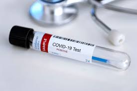 Apa Itu Rapid Test Perbedaan Rapid Test Antigen Dan Antibody