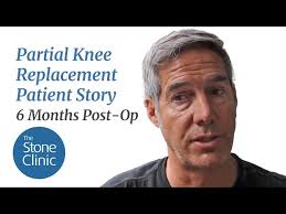 How to Ski Forever: One Patient's Quest to Extend the Life of His Knees &  His Skiing Years