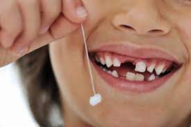 Shareably Kids Teeth Loose Tooth Baby Teeth