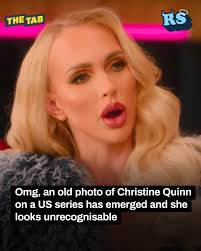 This was before she'd had any cosmetic surgery