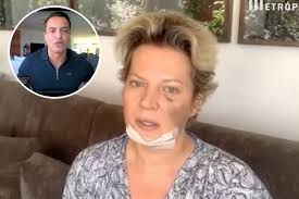 Ela fez questão de registrar a ocasião com uma foto ao lado de clemente bejuska. Joice Hasselmann Tem Dois Suspeitos Da Agressao Que Sofreu