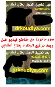 ترقيع غشاء البكارة 0022249165546 ليلة الدخله بالتفصيل طريقة فض غشاء البكارة بالصور