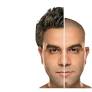 hair transplant in islamabad from www.skncosmetics.com