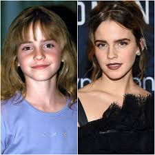 Emma Watson Transformation: From 'Harry Potter' to Now