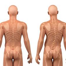 Scoliosis How To Treat A Curved Back