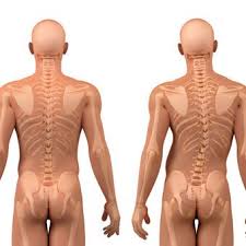 (below the lumbar spine is a bone called the sacrum, which is part of the pelvis). Scoliosis How To Treat A Curved Back