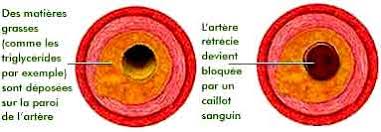 Bien sûr, je pense à mes parents quand je voyage. Triglycerides Eleves 4 Methodes Pour Baisser Le Taux