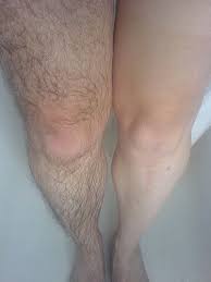 Not that men can't and don't remove leg hair, but if you look closely you'll also notice a rather large scar running down the knee of the hairless leg. Beauty Myths Baby Oil Iodine No More Hair Just A Little Blush