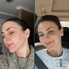 Haley Ballard || 30A + Destin Esthetician