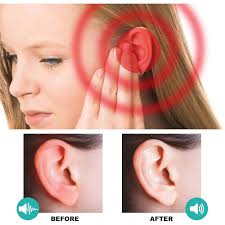 KOAHDE Tinnitus Relief Drops,Ear Ringing Relief Drops,Natural Ear Drops for  Tinnitus,Herbal Ear Ringing Relieving Drops,Tinnitus Ear Ringing Oil,Reduce  Ear Pain Drops,Ear Care Drops Relieve Tinnitus : Amazon.co.uk: Health &  Personal Care