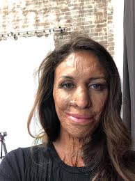 Turia Pitt