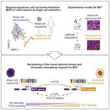 C-Fos Drives Reversible Basal To Squamous Cell Carcinoma Transition -  Sciencedirect