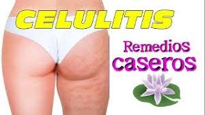 Como Eliminar La Celulitis De Las Piernas Y Gluteos Rapidamente Como Eliminar La Celulitis De Las Piernas Y Gluteos Rapidamente Sin Tratamiento Celulitis D Como Eliminar Las Celulitis Celulitis Piernas Eliminar Celulitis