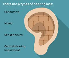 There Are 4 Types Of Hearing Loss Conductive Hearing Loss Sensorineural Hearing Loss Mixed Hearing Loss And C Hearing Loss Hearing Impairment Hearing Health