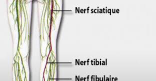 Il existe aucun traitement réellement efficace à 100% contre les sciatiques, que ce soit des médicaments ou du repos, rien n'y fait. Archives Des Sante Beaute Pastisnet