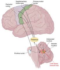 Image result for Ataxia