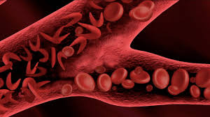 Drépanocytose traitement natuel