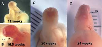 Image result for Chordee