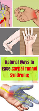 When A Nerve Becomes Compressed In The Carpal Tunnel The Obtained Condition Is Called Carpal Tunn Carpal Tunnel Syndrome Carpal Tunnel Carpal Tunnel Exercises