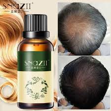 Our top pick is hair thickness maximizer organic hair growth oil. Hair Growth Essence Advanced Thinning Hair Hairregrowthtreatments Hair Growth Oil Hair Loss Essential Oils Hair Loss Shampoo