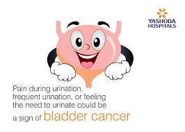The symptoms of prostate cancer often differ from patient to patient. Bladder Cancer Symptoms Pain During Urination Causes Diagnosis And Treatment